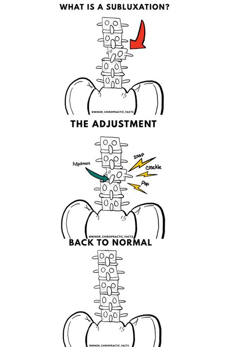 Chiropractor Adjustment, Chiropractic Educational Posters, Physio Therapy, Spine Health Chiropractic, Y Strap Chiropractic, Nature Office, Chiropractic Infographic, Spine Design, After Chiropractic Adjustment