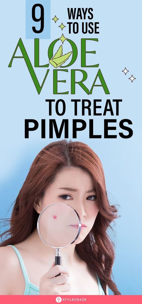 Almost all of us get acne at some point in our lives, and many of us try random home remedies to manage inflammation. Aloe vera is a popular home remedy that is used to soothe the skin. In this article, we have discussed why aloe vera is good for acne and how you can use it. #skincare #aloevera #acne Aloevera Skincare For Acne, Aloe Vera For Pimples, Aloe Vera For Acne, Aloe Vera Acne, Aloe Vera Benefits, Natural Acne Remedies, Home Remedies For Acne, Acne Remedies, How To Get Rid Of Acne