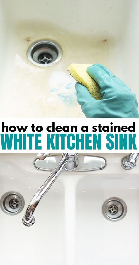 Clean White Sink, Enamel Sink, Kitchen Sink Cleaner, Kitchen Sink Diy, Remove Yellow Stains, Cleaning Hacks Tips And Tricks, White Farmhouse Sink, Clean Kitchen Sink, Off White Kitchens