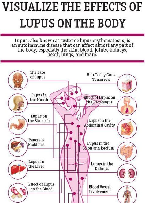 Autoimmune Disease Symptoms, Heart Lungs, Alkaline Diet, Autoimmune Disorder, Health Journey, Chronic Fatigue, Autoimmune Disease, Health Info, Lungs