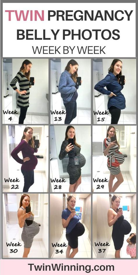 Pregnancy Belly Week By Week, Twin Belly, Twin Pregnancy Belly, 1 Week Pregnant, Baby Bump Progression, 4 Weeks Pregnant, 6 Weeks Pregnant, Breastfeeding Twins, Were Pregnant