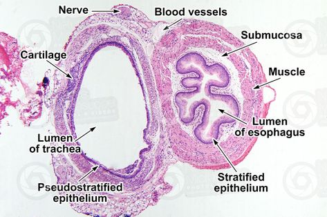 Respiratory System Histology, Trachea Histology, Respiratory System Anatomy, Tissue Biology, Comparative Anatomy, Histology Slides, Vet Notes, Animal Adaptations, Tissue Types