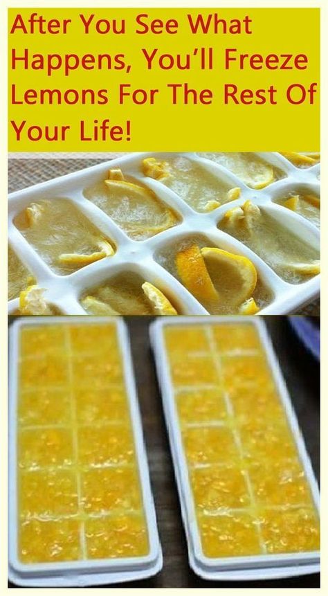 After You See What Happens, You’ll Freeze Lemons for the Rest of Your Life! Freeze Lemons, Freezing Lemons, Frozen Lemon, Ice Trays, Healthy Fruits, Frozen Food, Diet Tips, Herbal Remedies, Chutney