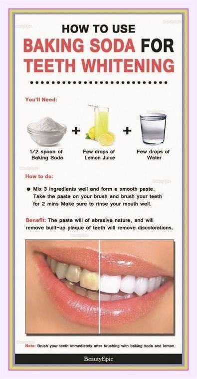 Baking Soda For Teeth, Brushing With Baking Soda, Baking Soda Lemon Juice, Natural Teeth Whitening Diy, Baking Soda Teeth, Baking Soda Teeth Whitening, Lemon Juice Water, Teeth Whitening Homemade, Baking Soda And Lemon