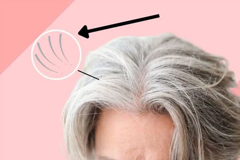 Frizzy Gray Hair Remedies, How To Keep Hair Out Of Face When Down, Gray Hair Frizz Control, Dry Gray Hair, Grey Hair Wax, Stop Grey Hair, Hair Frizz Control, Grey Hair Remedies, Prevent Grey Hair