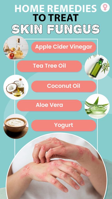 Home Remedies That Actually Help Treat Skin Fungus: These homemade treatments have been used for generations and use the power of nature to fight off the fungus. In this article, we will explore some easy and effective solutions to treat skin fungus. Read on! Skin Rash Remedies, Aloe Vera Image, Apple Cider Vinegar Tea, Skin Fungus, Oil Image, Fungal Infection Skin, Beauty Diet, Oregano Oil, Power Of Nature