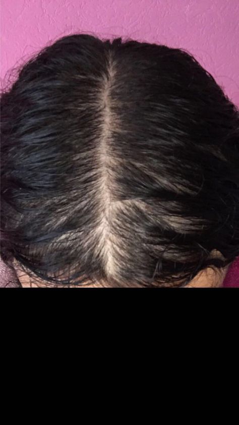 help Im only 16 and this is what my hair looks like when its wet! What should I do? I did blood tests and I dont have any deficiency. I take vitamins too. Any tips? :( Take Vitamins, Blood Test, My Hair, Hair Looks, Vitamins, Hair, Quick Saves, Beauty