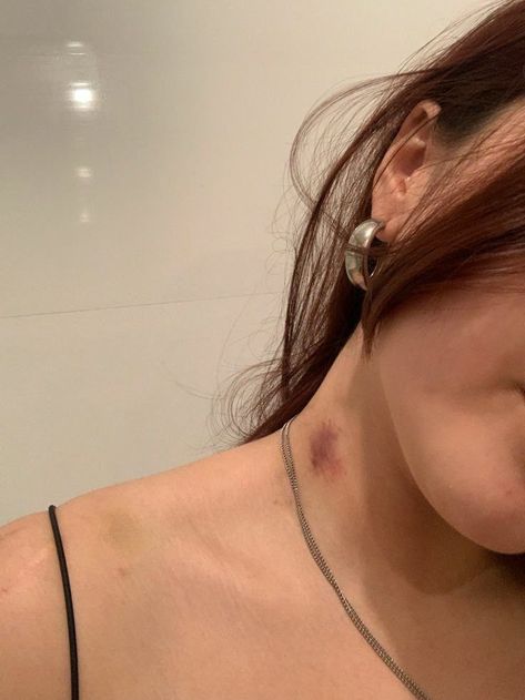 Neck Full Of Hickeys, Hickies Neck, Love Bite, Girls Tattoos, Breakup Picture, Girl Dpz, Love Bites, Cute Selfies Poses, Couples Poses For Pictures