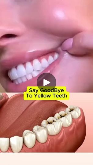 Facebook Tartar Recipe, White Teeth Tips, Whiten Your Teeth At Home, Natural Teeth Whitening Diy, Natural Teeth Whitening Remedies, Brighten Teeth, Get Whiter Teeth, Teeth Whitening Homemade, Teeth Whitening Remedies