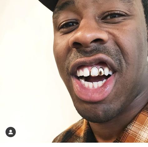 Sir Baudelaire, Girl Grillz, Grillz Teeth, Gold Grill, Short Twists, Dope Jewelry Accessories, Grills Teeth, Tooth Gem, Teeth Jewelry