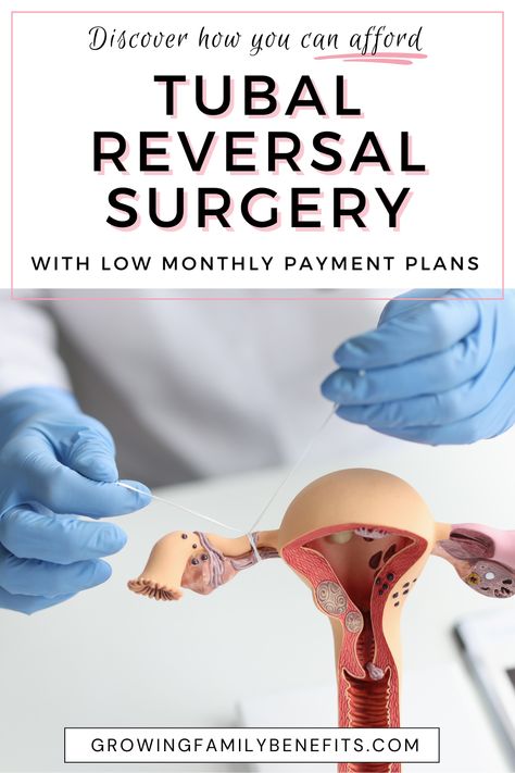 Dreaming of pregnancy after tubal reversal? Don't let the tubal reversal cost hold you back from the joy of having a baby after tubal reversal. Find out how flexible payment plans can turn your dreams into reality, making surgery costs manageable. This article is your friendly guide to understanding financing options that work for you. Tubal Reversal Surgery, Pregnancy After Tubal, Tubal Reversal, Birth Recovery, Neonatal Intensive Care Unit, Fallopian Tubes, Prenatal Care, Trying To Get Pregnant, Health Insurance Plans