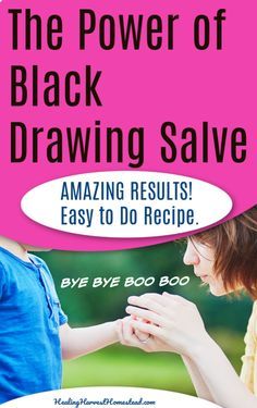 An easy homemade  black charcoal drawing salve recipe that really works! #healingharvesthomestead #homemade #diy #charcoal # stings # bites # homeremedies Drawing Salve Recipe, Black Drawing Salve, Diy Charcoal, Drawing Salve, Medical Jokes, Medical Mnemonics, Medical Brochure, Natural Remedies For Migraines, Salve Recipes