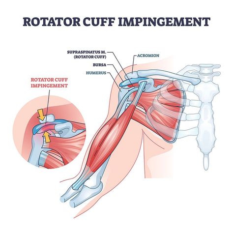 Sartorius Muscle, Shoulder Muscle, Shoulder Impingement, Trigger Point Therapy, Frozen Shoulder, Trigger Point, It Band, Science Notes, Rotator Cuff