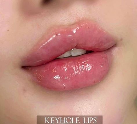 Pretty Full Lips, Cindy Kimberly Lips, Lip Shapes Filler, Full Lips Aesthetic, Perfect Lips Natural, Lips With Filler, Lip Filler Styles, Keyhole Lips, Desired Lips