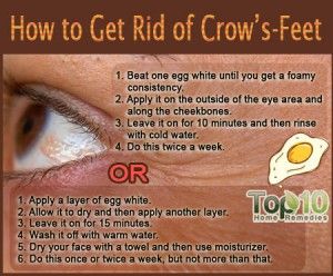 How to Get Rid of Crow’s-Feet Best Korean Eye Cream, Korean Eye Cream, Crows Feet Wrinkles, Top 10 Home Remedies, Healthy Remedies, Wrinkle Remedies, Late 30s, Laugh Lines, Beauty Remedies