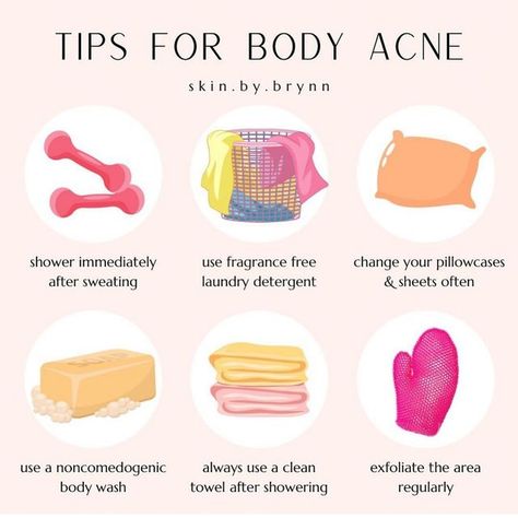 Tips For Back Acne, Body Acne Tips, How To Get Rid Of Body Acne, Body Acne Products, Body Acne Remedies, 2024 Tips, Skincare Education, Back Acne Remedies, Cystic Acne Remedies