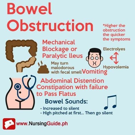 bowel obstruction Gastrointestinal Nursing, Nurse Teaching, Nursing School Prerequisites, Nursing Cheat, Medical Mnemonics, Med Surg Nursing, Nursing Student Tips, Nursing Schools, Medical Surgical Nursing