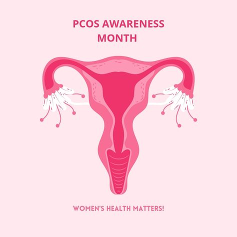 Did you know September is PCOS Awareness Month? PCOS, or polycystic ovary syndrome, affects an estimated 5-13% of women of reproductive age, often causing irregular periods, infertility, acne, excessive hair, and weight gain. Research is currently underway to figure out what causes PCOS and how to best treat it! Healthy Ovaries, Irregular Periods, Vision Board Images, Polycystic Ovaries, Health Matters, Womens Health, Weight Gain, Did You Know, Vision Board