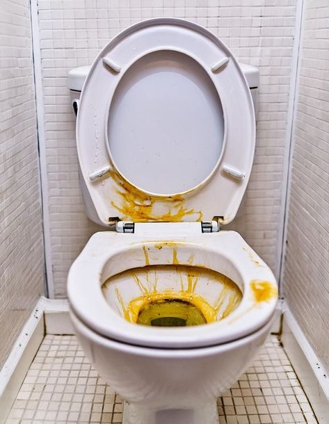 Tips for the Home Poop In Toilet, Remove Yellow Stains, Bathroom Ventilation, Homemade Cleaning Supplies, Over The Toilet, Vinegar Cleaning, Water Solutions, Vinegar And Water, Distilled White Vinegar