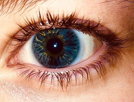 Unnatural Eye Color, Blue And Yellow Eyes, Unique Eye Color, Electric Blue Eyes, Pretty Eyes Color, Heterochromia Eyes, Deep Blue Eyes, Blue Eyes Aesthetic, Multi Colored Eyes