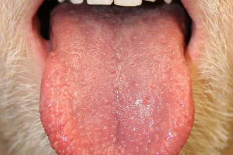 Bumps on the Tongue: What It Could Mean | Reader's Digest Bumps On Tongue, Tongue Sores, Squamous Cell, Liver Detoxification, Tongue Health, Wax Strips, The Tongue, Autoimmune Disorder, Cold Sore