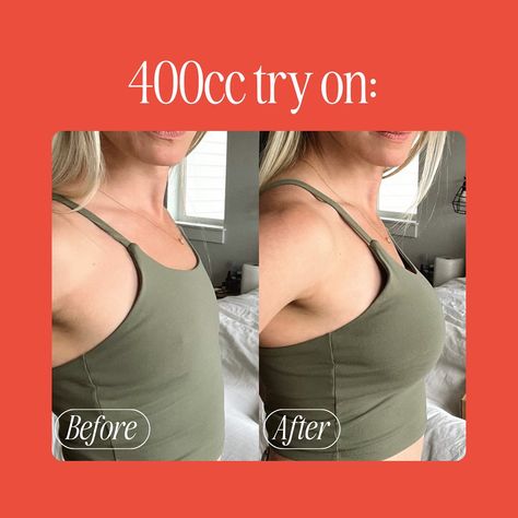 Swipe to see what 400cc Auggie breast implant sizers look like tried on. What sizes do you want to see tried on next? #TryAuggie #breastaug #plasticsurgery #breastlift #bodyconfidence #beforeandafter Try Before You Buy | Breast Implant Try On | Breast Augmentation Breast Lift, Body Confidence, Breast Augmentation, Plastic Surgery, Try On