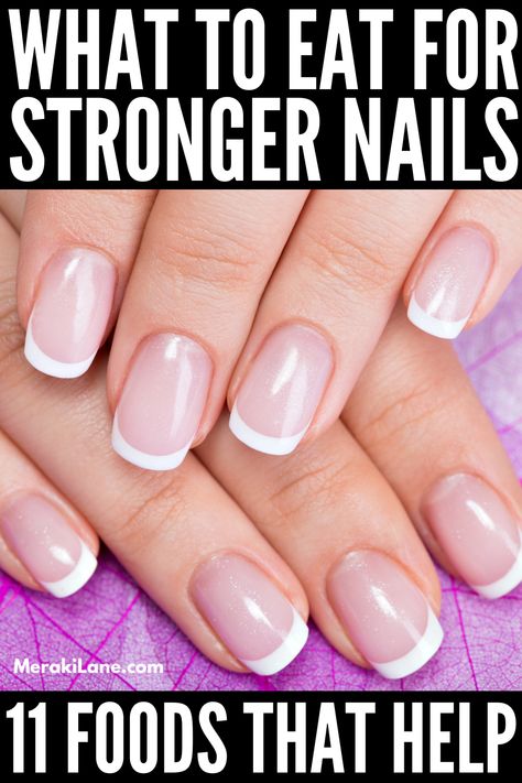 Nail Remedies, Nail Growth Tips, Grow Nails Faster, Nail Problems, Nail Vitamins, Nail Infection, Weak Nails, Natural Detergent, Brown Spots On Face