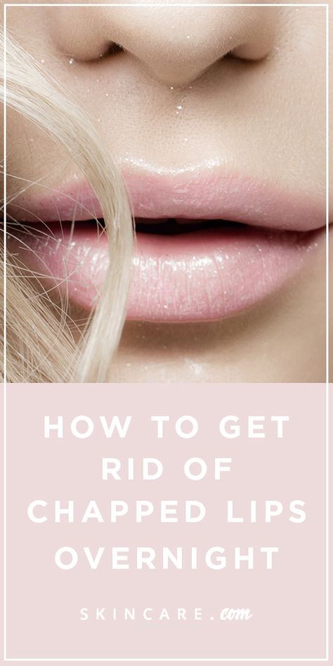 Wondering how to get rid of chapped lips overnight? From cleansing with micellar water to exfoliating dry skin to hydrating with a nourishing lip balm, we share the best way to get rid of chapped lips overnight, here. Black Spots On Face, Spots On Forehead, Brown Spots On Hands, Overnight Skin Care, Brown Age Spots, Brown Spots On Skin, Spots On Legs, Dark Spots On Face, Brown Spots Removal