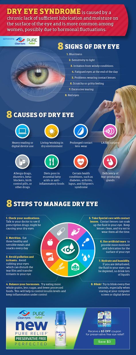 [Infographic] Dry Eye Syndrome: 8 signs, causes and treatments. Dry Eyes Causes, Lasik Surgery, Eye Infections, Dry Eye, Healthy Eyes, Eyes Problems, 8th Sign, Dry Eyes, Eye Health