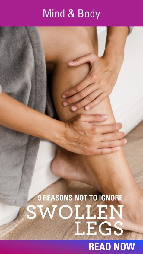 WellTuned shares 9 reasons why swollen legs should never be ignored Heavy Legs Remedies, Shortness Of Breath Remedies, Medical Remedies, Last Week Of Pregnancy, Calf Cramps, Inflammatory Recipes, Running Techniques, Heavy Legs, Venous Insufficiency