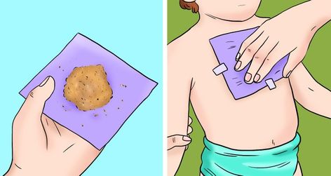 6 Signs Your Body Is Producing Excessive Mucus and How to Stop It / Bright Side Honey Wrap, Getting Rid Of Mucus, Ginger Wraps, Severe Cough, Cough Relief, Persistent Cough, Cold And Cough Remedies, Turmeric Milk, Honey Water