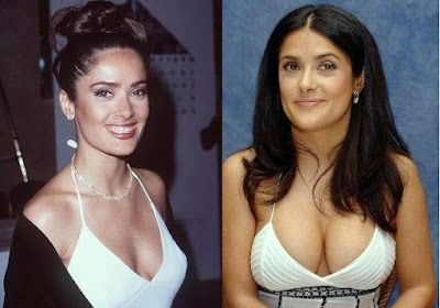 Breast Lift Surgery Before And After, Salma Hayek Young, Surgery Nose, Salma Hayek Body, Salma Hayek Style, Selma Hayek, Jenifer Aniston, Celebrity Plastic Surgery, Breast Surgery