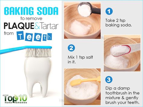 baking soda to remove paque and tartar from teeth How To Remove Plaque, Natural Teeth Whitening Remedies, Tartar Teeth, Plaque Teeth, Teeth Whitening Homemade, Top 10 Home Remedies, Teeth Whitening Remedies, Dental Fillings, Health Improvement