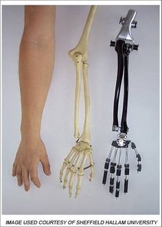 artificial muscle for bionic robot arm - Google Search Stepford Wives 1975, Prosthetic Arm, Stepford Wives, Robot Hand, Robotic Arm, Humanoid Robot, I Robot, Arte Robot, Robot Design