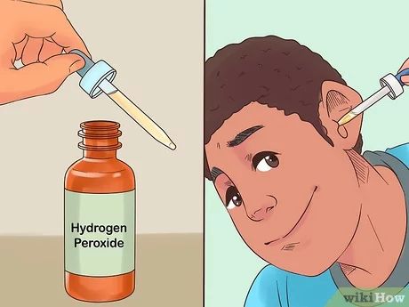 3 Ways to Remove Fluid in Ears - wikiHow Water In Ear Remedy, Drain Ear Fluid, Water In Ear, Clogged Ear Remedy, Swimmers Ear Remedy, Unclog Ears, Ear Drainage, Blocked Ears, Fluid In Ears