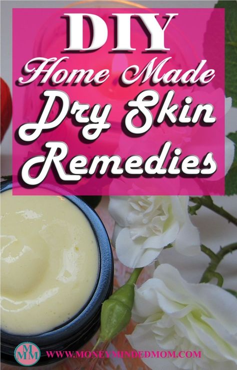 Homemade Moisturizer, Dry Skin On Face, Moisturized Skin, Dry Skin Remedies, Combination Skin Type, Dry Itchy Skin, Diy Remedies, Homemade Diy, Dry Skin Care