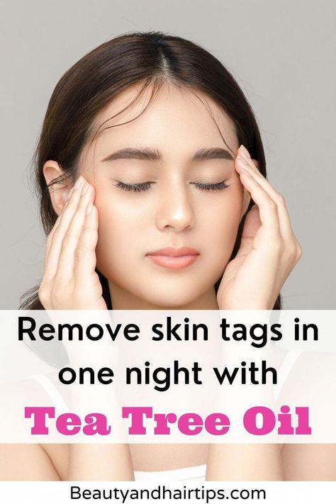 #NaturalSleepRemedies Skin Tags Removal, Skin Tags On Face, Remove Skin Tags, Remove Skin Tags Naturally, Remove Unwanted Hair, Get Rid Of Warts, Skin Natural Remedies, Skin Tags, Cold Sores Remedies