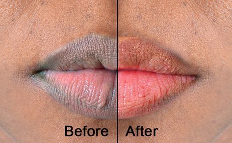 There are some items at home you can use to brighten your lips naturally. You will be amazed at how this works wonders. Apply Cucumber Juice Lighten your dull lips by applying a cut of cucumber immovably all the rage for the juice to soak on. On the off chance that you rehash it five […] Pink Lips Cream, Natural Lip Stain, Natural Pink Lips, Lip Lightening, Pink Lip Balm, Hot Pink Lips, Lip Care Routine, Pigmented Lips, Sugar Lip Scrub