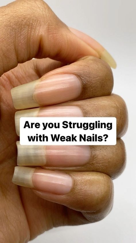 Ways to Grow Your Nails Super Fast Grow Long Nails, Grow Nails Faster, Long Natural Nails, Weak Nails, Damaged Nails, Nail Care Tips, Nail Health, Beauty Recipe, Free Guide