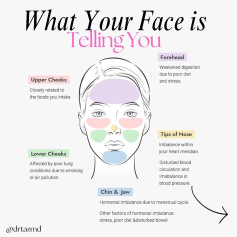 Face mapping is important for understanding hormonal health because it helps identify how different areas of the face correspond to specific internal organs and hormonal imbalances. By examining breakouts, discoloration, or other skin issues in certain facial regions, practitioners can gain insights into underlying hormonal imbalances or health issues, allowing for more targeted and effective treatments. Send this to your skin bestie 👯‍♀️🩷 #skincare #skincaretips #skinhealth #skingoals #s... Skincare For Hyperpigmentation, Get Rid Of Dry Skin, Face Massage Anti Aging, Hormonal Imbalances, Hormonal Breakouts, Facial Tips, Hormonal Health, Pimples On Face, Face Mapping