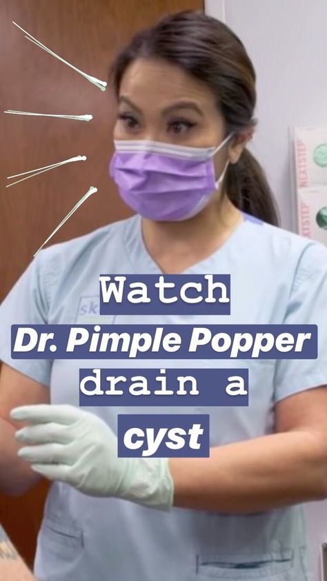 Watch Dr. Pimple Popper drain a bloody cyst that reminded her of Shamu the whale Head Pimples, Pimple Popper Videos Black Heads, Pimple Popper Tool, Cystic Pimple, Losing 40 Pounds, Get Rid Of Blackheads, Homecoming Makeup Browneyes, Skin Care Order, Homecoming Makeup Looks