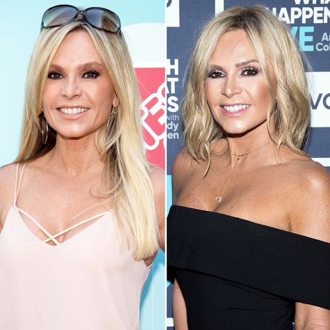 Tamara Judge Hair, Tamra Judge Hair, Tamara Judge, Lower Face Lift, Tamra Judge, Face Lift Surgery, Celebrity Plastic Surgery, Bravo Tv, Beautiful Hairstyles