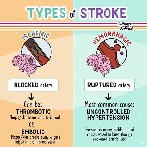 Types of Strokes #nursingschool #nursingstudent #study  - Image Credits: Nurse Well Versed Nursing Fundamentals Study Guides, Nursing Neuro, Nursing School Studying Cheat Sheets, Nursing School Inspiration, Types Of Strokes, Paramedic School, Nursing Study Guide, Nursing School Motivation, Medical School Life