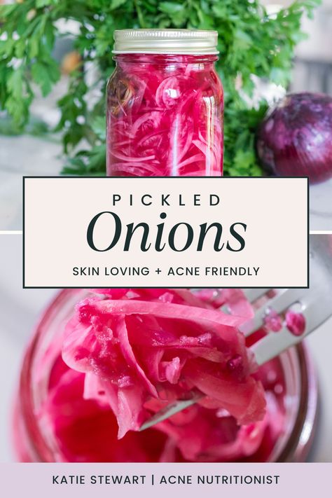 Pickled Onions Salad Recipes With Pickled Onions, Canned Pickled Onions Canning Recipes, Picketed Onions, How To Make Pickled Onions, Pickled Purple Onions, Pickling Onions, Pickled Onions Recipe, Smashed Red Potatoes, Pickle Onions Recipe