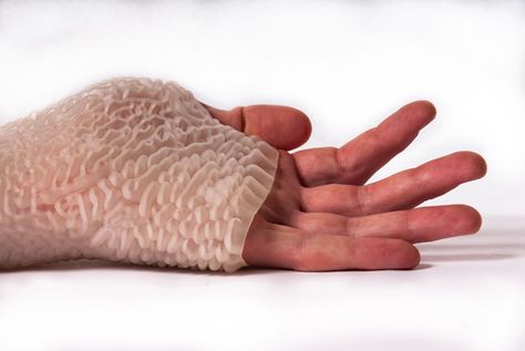 Urban Lab Global Cities (ULGC): Carpal Skin by Neri Oxman Neri Oxman, Median Nerve, Muscle Atrophy, Architectural Competition, Digital Fabrication, Landscape And Urbanism, Architecture Magazines, Carpal Tunnel, 3d Printing Technology