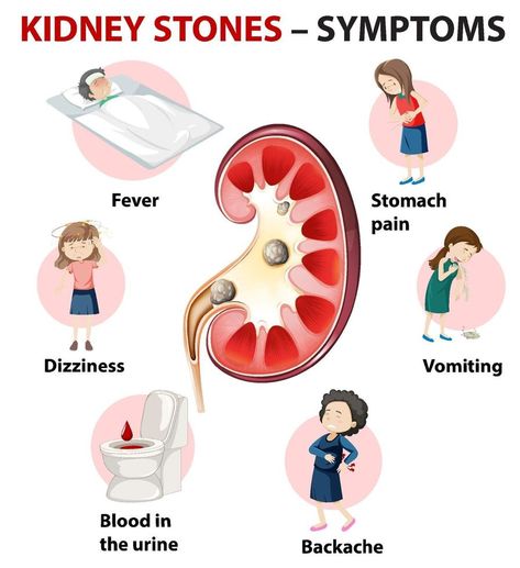 Kidney Symptoms, Kidney Pain, Low Estrogen Symptoms, Too Much Estrogen, Estrogen Dominance, Baking Soda Shampoo, Breast Health, Kidney Health, Stomach Pain