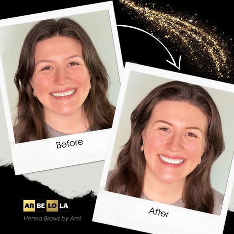 Check out the gorgeous transformation with Brooke’s henna brows! 🌿 The before-and-after results speak for themselves – bold, beautiful, and natural! 💕
Henna brows are a perfect solution for enhancing your brow shape, adding depth, and giving you that fuller look without the commitment of permanent makeup. 🙌
https://arbelola.com/hennabrows/

#Arbelola #ArbelolaBeauty #HennaBrows #BrowTransformation #BeforeAndAfter #BrowGoals #NaturalBrows #HennaBeauty #PerfectBrows #HennaBrowResults Henna Brows, Natural Henna, Natural Brows, Brow Shaping, Perfect Brows, Full Look, Permanent Makeup, Henna, Makeup