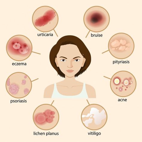 Diagram showing different sickness | Free Vector #Freepik #freevector #physiology #anatomy #human-body #human-anatomy Sickness Illustration, Diagram Illustration, Parent Newsletter, Skin Disorders, Skin Diseases, Skin Issues, Homeopathy, Kids Health, Oils For Skin