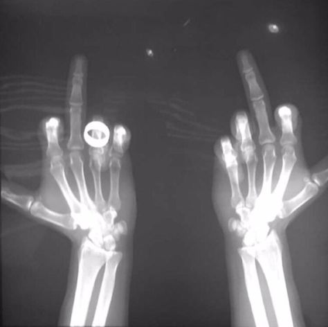 SKELETON MIDDLE FINGER FLIPPING THE BIRD BONES AESTHETIC Middle Finger Picture, Finger Wallpaper, Middle Finger Wallpaper, Xray Art, Skeleton Art, Wallpaper Animes, Funny Wallpaper, Black And White Aesthetic, Black Aesthetic Wallpaper