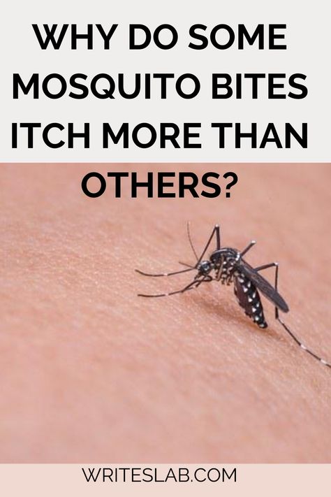 WHY DO SOME MOSQUITO BITES ITCH MORE THAN OTHERS? Stop Mosquito Bite Itch, Mosquito Repellent Lotion, Mosquito Bite Itch, Grilling Party, Remedies For Mosquito Bites, Female Mosquito, Grill Party, Outdoor Grilling, Mosquito Bites